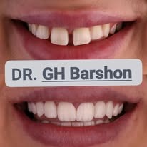 Advanced Dental Procedure